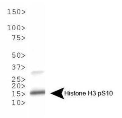 Western Blot: Histone H3 [p Ser10] Antibody [NB21-1091]
